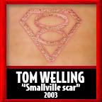 Tom Welling Smallville scar